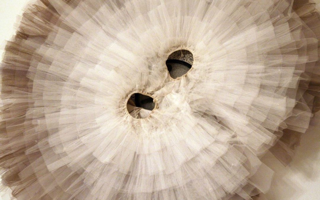 Ask Amy: How Do I Keep My Tutu From Sticking Up?