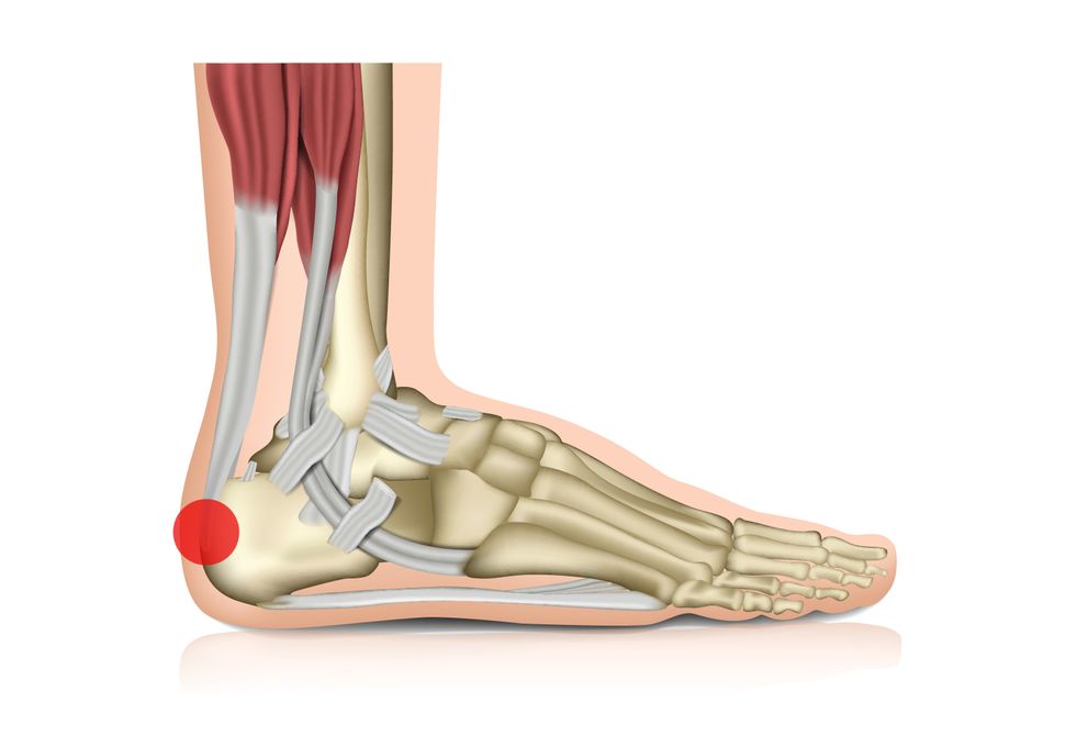 Digital drawing of a foot's bones and muscles, with a red dot on the back of the heel.