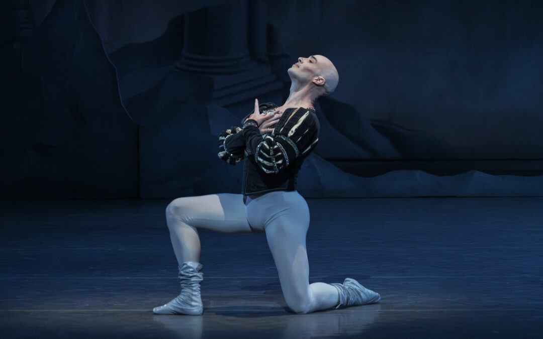 The Bald Prince: Is the Tide Turning for Dancers Experiencing Hair Loss?